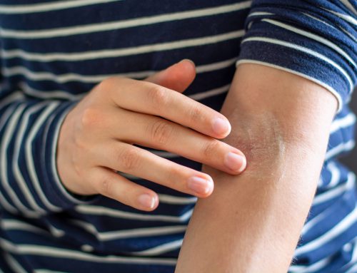 That Itchy Patch On Your Skin May Need Medical Attention